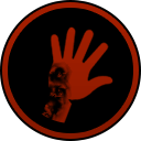 Necrotizing Fasciitis