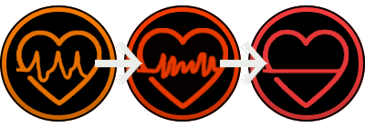 Fibrillation